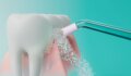 Philips Sonicare Cordless Power Flosser 3000 HX3826/33 szájzuhany