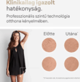 Braun Silk-expert Pro 5 PL5152 IPL szőrtelenítő