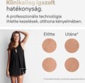 Braun Silk-expert Pro 5 PL5267 IPL szőrtelenítő